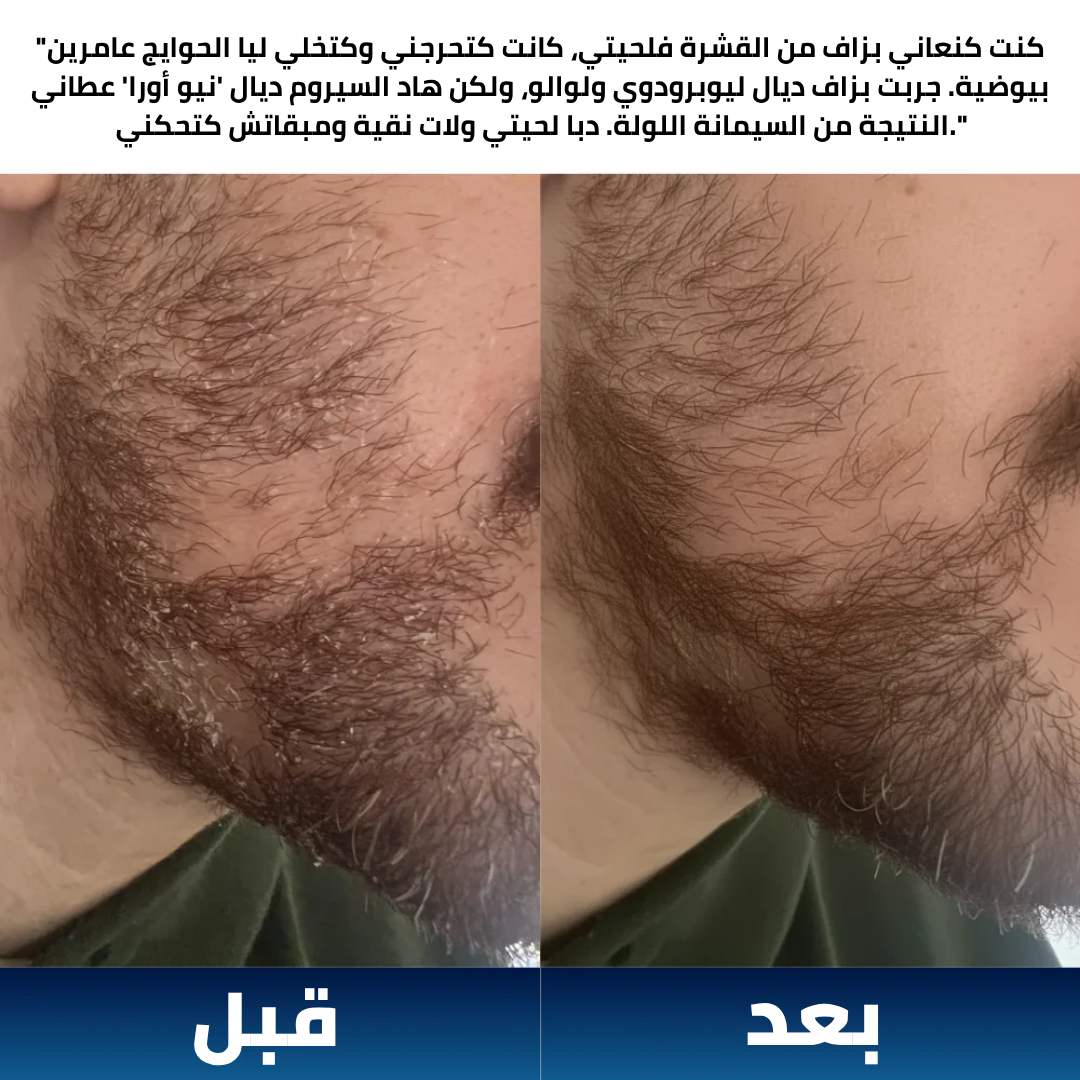 شامبو New Aura الطبي المضاد للفطريات - NEW AURA